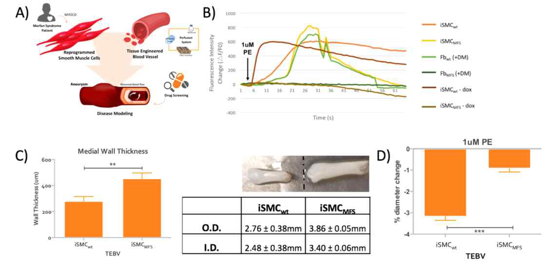 Modeling Marfan syndrome using iSMC TEBV. A) Illustration depicting the experimental design of our study. (B) Functional characterization of iSMCMFS. Calcium wave in response to 1uM phenylephrine for varying cell groups as indicated. (C) Measurements of medial wall thickness, outer diameter (O.D.) and inner diameter (I.D.) of iSMCwt and iSMCMFS TEBV. Images of iSMCwt and iSMCMFS TEBV demonstrate the distinct difference in their outer diameter. (D) Vasoactivity levels of iSMCwt and iSMCMFS TEBV measured by the vessel diameter change upon addition of 1uM PE