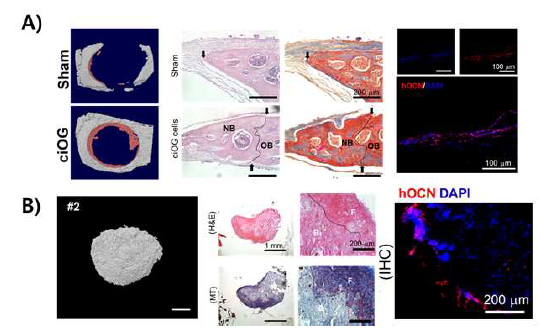 A) 면역결핍마우스에 두개골에 유도된 조골세포를 이식하고 12주 후 microCT와 histology 분석 b) 면역 결핍마우스 피하조직에 유도된 조골세포를 이식하고 8주 후 microCT와 histology 분석