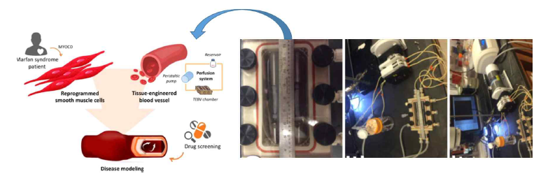 Perfusion system combining collagen gel and cells, used to reprogram SMC and blood vessels for disease modeling. Ji H et al., Biomaterials (in review)