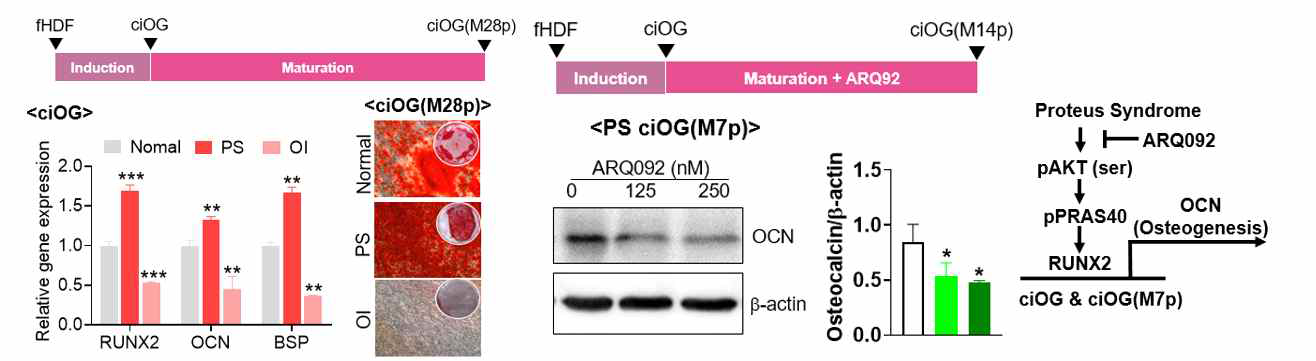 Chemically induced osteogenic cells (iOG) applicable for disease modeling related with bone (Osteoimperfecta, Proteus Syndrome); to be submitted