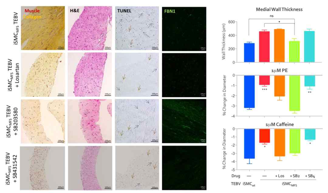 Drug response of iSMC-MFS TEBV to 1μM losartan, 1μM SB203580, or 1μM SB431542. Ji H et al, Biomaterials, in review