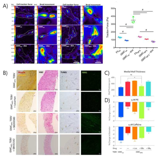 Modeling Marfan syndrome using iSMC TEBV. A) Cell traction force was indirectly measured by the movement of bead in acrylamide hydrogels by cellular force. iSMCMFS dox revealed ~5 times reduction of cell traction force compared to iSMCwt-dox, confirming the normal physiologic behaviors (possibly less contractility) of SMC from MFS patient (statistical difference between groups, # p<0.05, n=3). B) Histological analysis of iSMCMFSTEBV, iSMCMFSTEBV with losartan, and iSMCMFSTEBV with SB203580, iSMCMFSTEBV with SB431542 stained for pentachrome, H&E, TUNEL, and anti-FBN1. C) Measurements of medial wall thickness, and D) vasoactivity levels in response to 1μM phenylephrine (top) and 1μM caffeine (bottom), for iSMCwt TEBV (positive control), iSMCMFS TEBV (negative control), iSMCMFS TEBV with losartan, iSMCMFS TEBV with SB203580, and iSMCMFS TEBV with SB431542 (negative drug control)