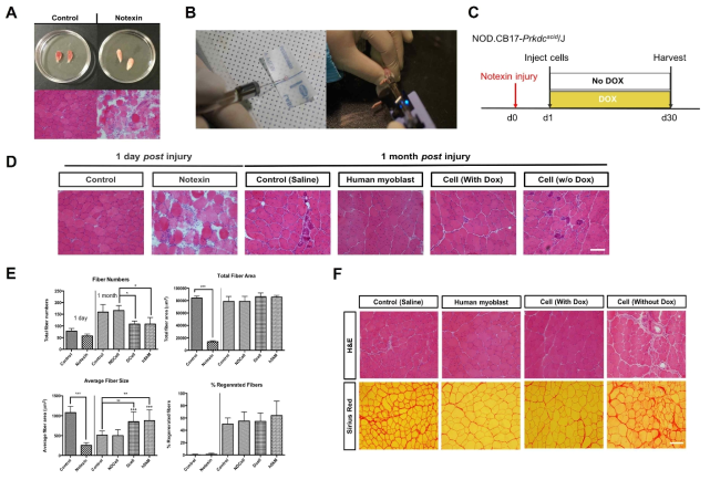 (A) One day post injury of the harvested TA muscles, (B) The process of cell transplantation: Cell loading and injection using the Hamilton syringe and the stereotoxic syringe pump, (C) Schematic diagram of the in vivo study scheduled for the NOD scid model, (D) Morphometric analysis of H&E-stained TA muscle sections (200x) with the established notexin-induced muscle injury model (1day) and the regenerated injury sites 1 month after the injury compared to its saline control (scale bar, 100um), (E) Quantitative analysis based on the H&E staining results for one day and one month post injury of the TA muscles, (F) The consecutive H&E and Sirius red stained TA muscle images (200x) of the in vivo reprogramming towards skeletal muscle cells after a month of notexin-induced injury (scale bar, 100um)