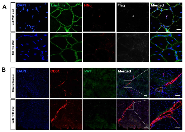 (A) Transverse cryosections of the EPCs transplanted mouse TA muscle indicating the engraftment of the transplanted cells directly reprogrammed to human skeletal muscle cells in vivo after a month of injury (scale bar, 20um), (B) Induction of angiogenesis by the transplanted cells with dox and saline control at the muscle injury site (scale bar, 100um (left) and 500um (right))