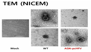 ADA 함유 가짜 바이러스 입자의 EM 사진