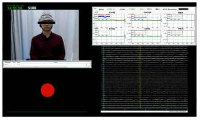 뇌기능 모니터링 시스템