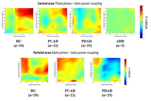 뇌파 Cross-frequency coupling 분석 결과