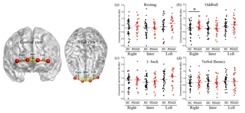 fNIRS 신호를 이용한 기능적 연결성 분석 결과 (HC(n=47), PDAD(n=33); p-value *: p<0.05)