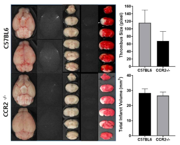 C57BL/6 생쥐 및 CCR2 knock out 생쥐 대뇌-색전 증 모델 유발 후 tPA 혈전용해제 처리 24시간 뒤 NIRF 혈전 영상 및 TTC 염색 사진