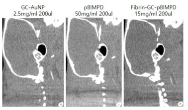 BIMPD 나노입자의 mCT 혈전조영능력 확인