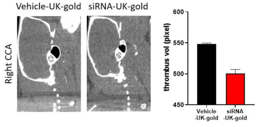 Vehicle-UK-gold / CCR2 siRNA-UK-gold 처리 후 24시간 뒤 생성된 재발성 혈전의 크기 비교