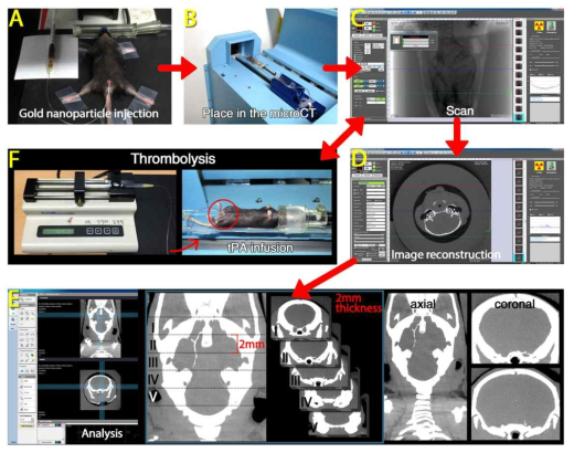 mCT를 이용한 in vivo 실시간 혈전 영상화 및 tPA 치료 모니터링
