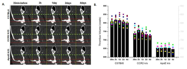 wild type 생쥐와 monocyte가 증가, 감소되어 있는 CCR2 knock out 생쥐에서 A, 시간대별 mCT 혈전 영상 B. 각 생쥐에서 생성된 경동맥-혈전의 시간대별 혈전부피비교 그래프