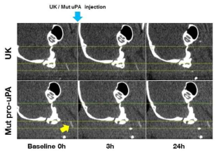 FeCl3 경동맥 혈전증 생쥐 모델에서 Mut pro-uPA injection후 혈전의 변화를 관찰한 mCT image