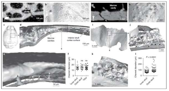 생쥐와 인간의 두개골과 뇌 사이의 미세통로를 mCT를 이용해 관찰한 이미지