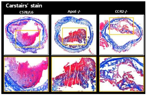 각 생쥐에 FeCl3로 총경동맥 혈전을 유발시킨 후 관찰한 Carstairs' stain 현미경 사진. 100배 영상 (위), 200배 영상 (아래)