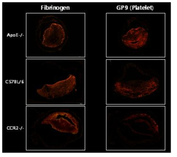 각 생쥐 모델의 총경동맥에 FeCl3를 처리해 유발시킨 혈전 내 fibrinogen 및 GP9 발현 비교분석