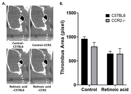 Tissue factor를 감소시키는 약물인 retinoic acid를 주입한 후, C57BL/6, CCR2 knock out 생쥐에서 혈전증 유발 30분째 in vivo 혈전영상 (A). 각 생쥐에서 경동맥 혈전 부피를 비교 분석한 결과 (B)