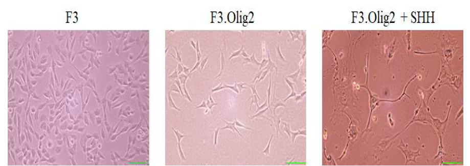 F3, F3.Olig, SHH를 처리한 F3.Olig2의 현미경 사진