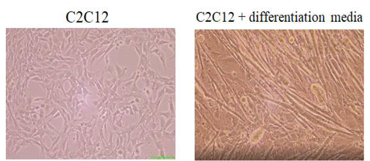 C2C12와 분화시킨 C2C12의 현미경 사진