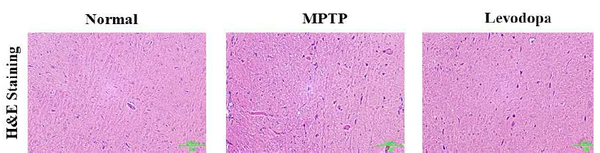 파킨슨을 유발한 Rat에서의 H&E staining 결과