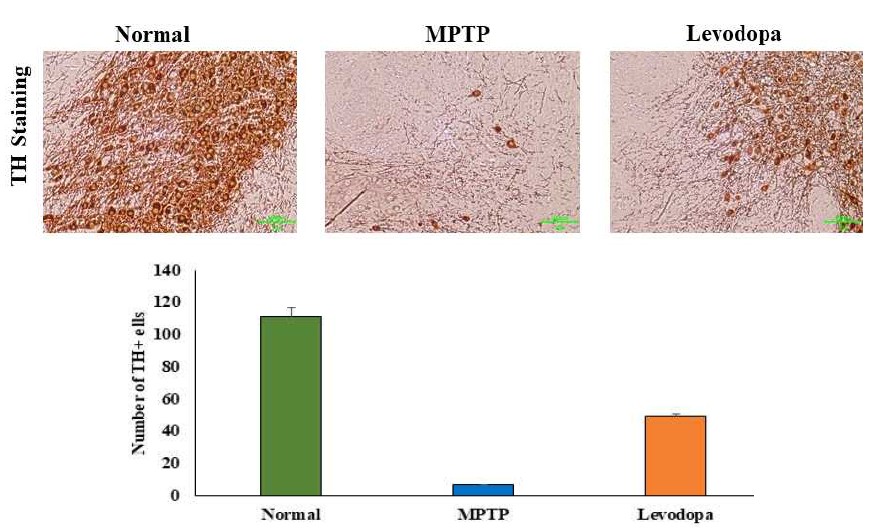 파킨슨을 유발한 Rat에서의 TH staining 결과