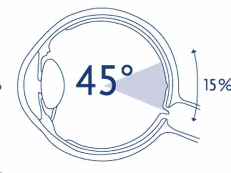 일반적인 망막안저사진의 촬영 영역 (약 30-45°)