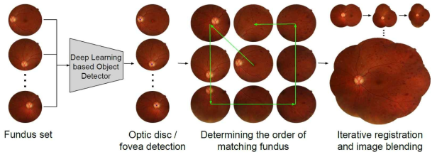 본 연구에서 제안한 복수의 망막안저사진에서 광각안저사진을 구성하는 방법