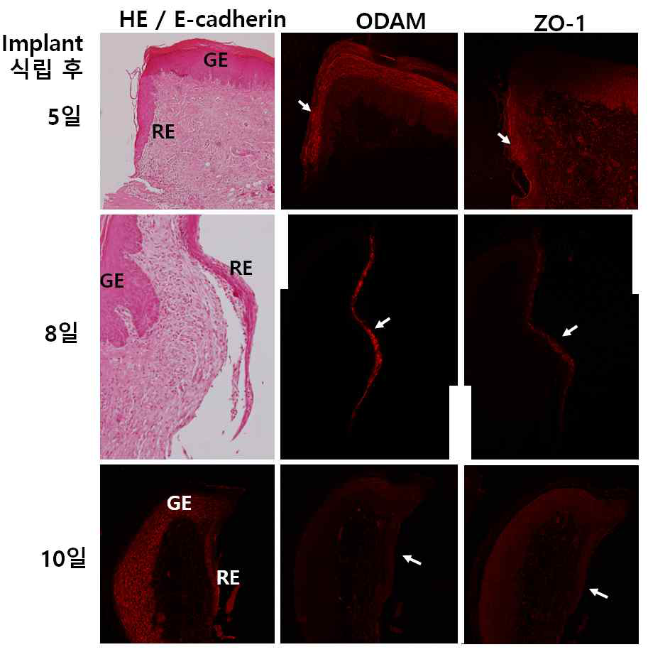 임플란트 식립 후 재생되는 재생 상피(RE)에서 ODAM과 ZO-1의 발현 양상을 보여주는 면역조직화학 결과. rat