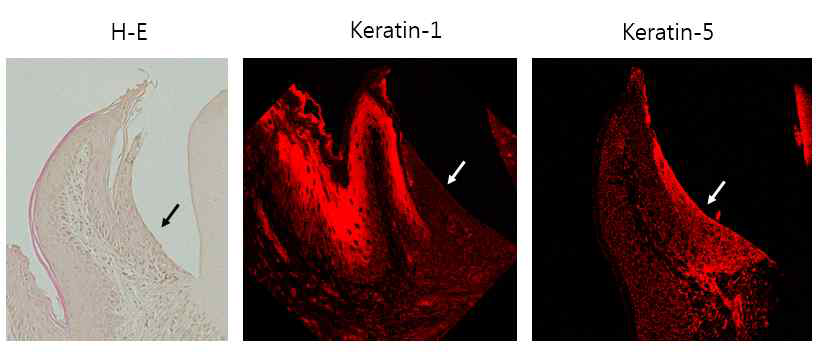 접합상피의 분화정도. 접합상피는 저분화 각화상피세포에서 발현하는 keratin-5가 발현하였고, 열구 및 주변 치은상피는 고분화 각화상피세포가 발현하는 keratin-1가 발현하였다. 이는 접합상피가 미분화된 세포단계에 멈춰있는 세포임을 알 수 있게 하였다