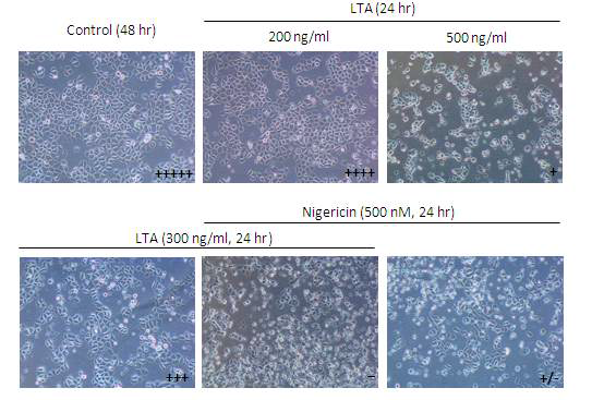 Gram (+) 독소인 LTA와 선천면역 반응의 inflammasome을 활성화 시켜 염증 반응을 중진시키는 nigericin을 치은상피세포주 배양에 처리한 결과