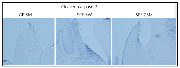 접합상피에서 cleaved caspase-3의 발현