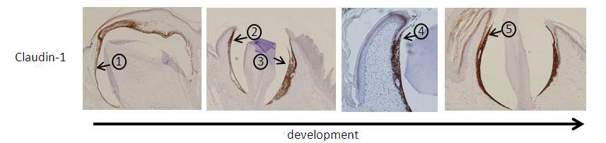 접합상피와 열구상피의 발생과정을 보여주는 claudin-1 면역조직화학 결과