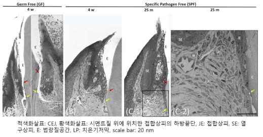 접합상피의 비세균성 하방이동