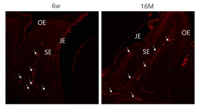 접합상피의 감각신경 분포. 어린 mouse와 노령 mouse에서 calcitonin gene related protein(CGRP)의 분포 비교