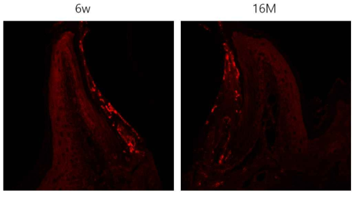 mouse 치은의 cyclophilin D 의 발현 양상. 6주 령 및 16개월 노령쥐 모두 접합상피에서 강한 발현을 보이는데 결합조직에서도 발현 부위가 나타나는 것으로 보아 백혈구에서 발현할 가능성도 배재할 수는 없었다