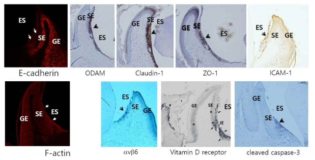 접합상피에 특이하게 강하게 발현하는 분자에 대한 면역조직화학염색 결과. ICAM-1을 제외하고는 모두 mouse 치은이며 ICAM-1은 rat 치은이다
