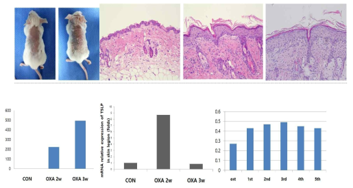 Oxazolone 유발 마우스 모델의 표피두께증가 및 TSLP, IgE, Ear thickness 변화