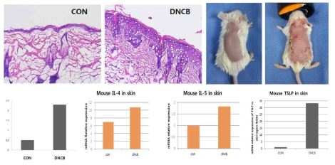 DNCB유발 아토피피부염 마우스모델의 피부염유발정도 및 IgE, IL-4, IL-5, TSLP 발현 증가