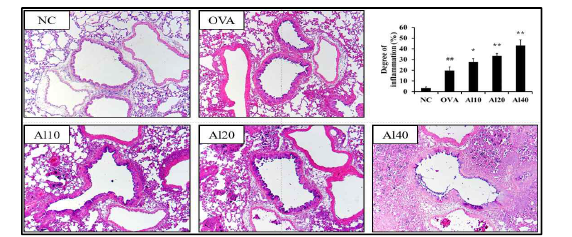 산화알루미늄 나노입자의 흡입노출에 의한 염증반응의 증가