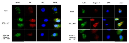 Confocal microscope에서 ASC, NLRP3, caspase-1의 결합억제