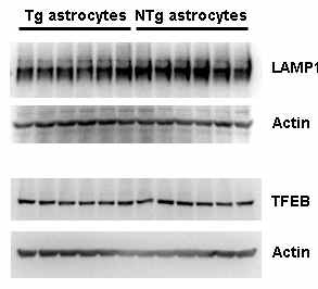 G93A SOD1 돌연변이 발현 astrocytes와 wild type astrocytes 에서의 라이소좀 단백질 변화