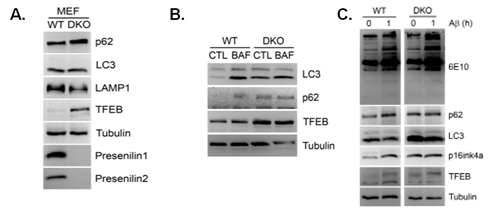 PS1/2 DKO 세포에서의 라이소좀 및 자식작용 억제와 Aβ 단백질 축적과 노화 마커 증가