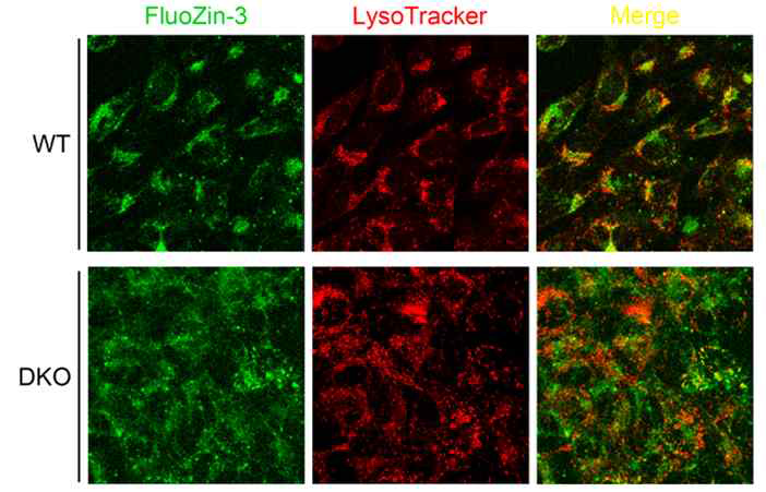 PS1/2 DKO 세포 내 아연 분포