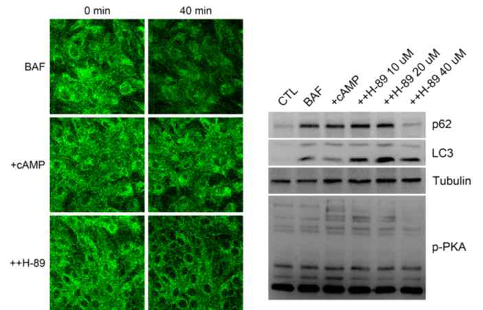 PKA 억제제와 cAMP에 의한 라이소좀 및 자식작용 활성 억제