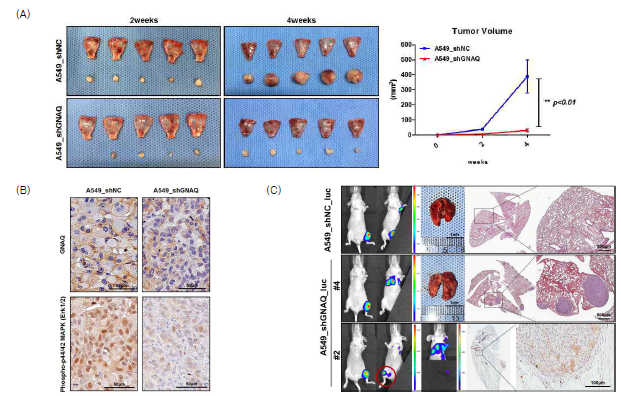 (A-B) Nude mouse의 머리덮개뼈(calvarial bone)에서의 종양 생성 및 종양 성장과 관련된 바이오마커를 면역조직화학염색(immunohistochemistry)를 통해 확인함. (C) Nude mouse의 우측 다리에 A549_shNC_luc 세포와 A549_shGNAQ_luc 세포를 주입 60일 후, GNAQ 유전자 변이에 따른 전이를 확인함. 또한 육안 및 H&E 염색으로 폐 용종(polyp)의 형성을 확인함