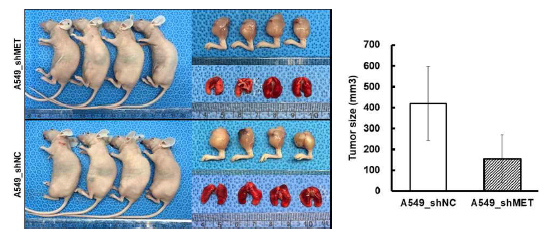 Nude mouse의 우측 다리에 A549_shNC 세포와 A549_shMET 세포를 주사하고 6주 후 종양의 크기를 측정하여 비교함