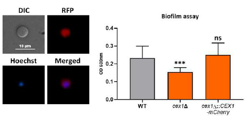 cex1::CEX1-mCherry 회복균주 (a) CEX1-mCherry 의 세포 내 위치 (b) 회복균주의 미생물막 형성정도 회복 확인