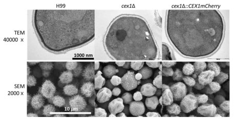 CEX1이 조절하는 세포 외벽 표현형 관찰 (위) 투과전자현미경(TEM) 결과 (아래) 주사전자현미경(SEM) 결과