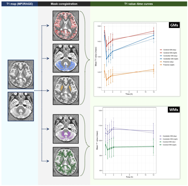 다양한 뇌영역에서의 글림프계 활동으로 인한 시간에 따른 T1값의 변화
